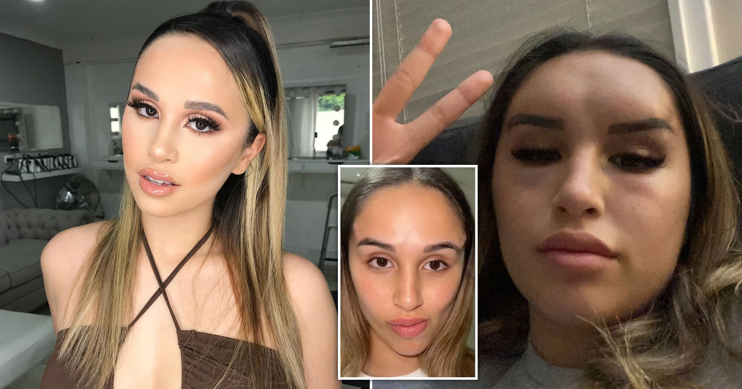 Photo of What Should We Do When Cosmetic Surgery Procedures Go Wrong?