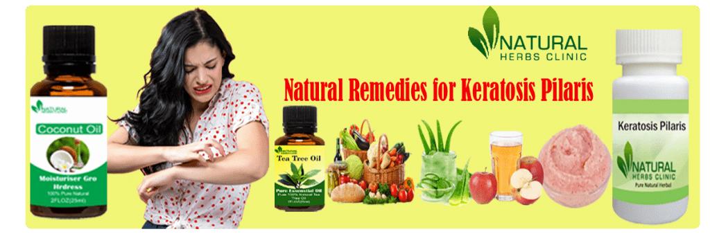 Photo of Natural Supplement and Home Remedies for Keratosis Pilaris